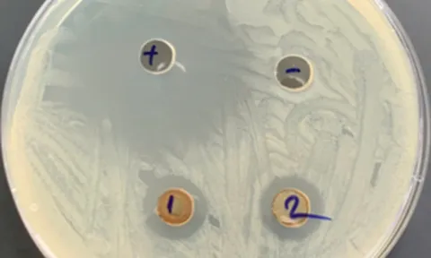 Đánh giá khả năng kháng khuẩn của màng polypropylene phủ graphene oxide (PP/GO)